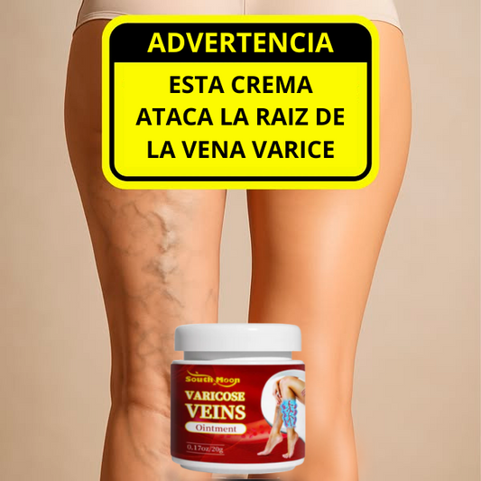Varicose Veins  Crema Varices